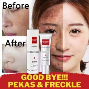 𝐘𝐨𝐮𝐛𝐮𝐲 𝐖𝐡𝐢𝐭𝐞𝐧𝐢𝐧𝐠 𝐂𝐫𝐞𝐚𝐦